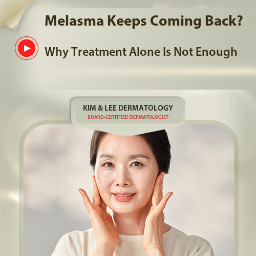 Melasma: Why Does It Come Back After Treatment?