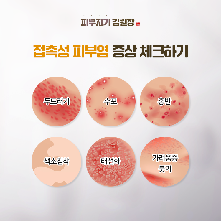 접촉성 피부염, 자극성과 알레르기성은 어떻게 다른가요? 관련 해부 구조 그림