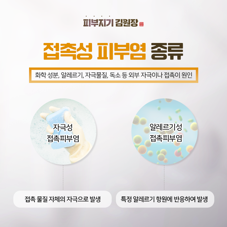 접촉성 피부염, 자극성과 알레르기성은 어떻게 다른가요? 관련 해부 구조 그림